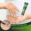 KEM MỠ HẾT ĐAU NHỨC XƯƠNG KHỚP MỎI CỔ VAI GÁY. TĂNG SỨC KHỎE CHO CƠ VÀ GIẢM NGUY CƠ VIÊM KHỚP