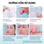 SET 3 MÓN_ Ủ mụn đầu đen, sợi bã nhờn Super Melting Sebum Softener + thanh đẩy mụn tặng kèm bông