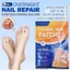 Miếng dán chỉnh sửa chăm sóc móng chân - Thoáng khí, tự dính - Miếng dán chỉnh sửa ngón chân có thể điều chỉnh - Miếng dán sửa móng tay dày - Máy duỗi dùng một lần / Giao hàng miễn phí