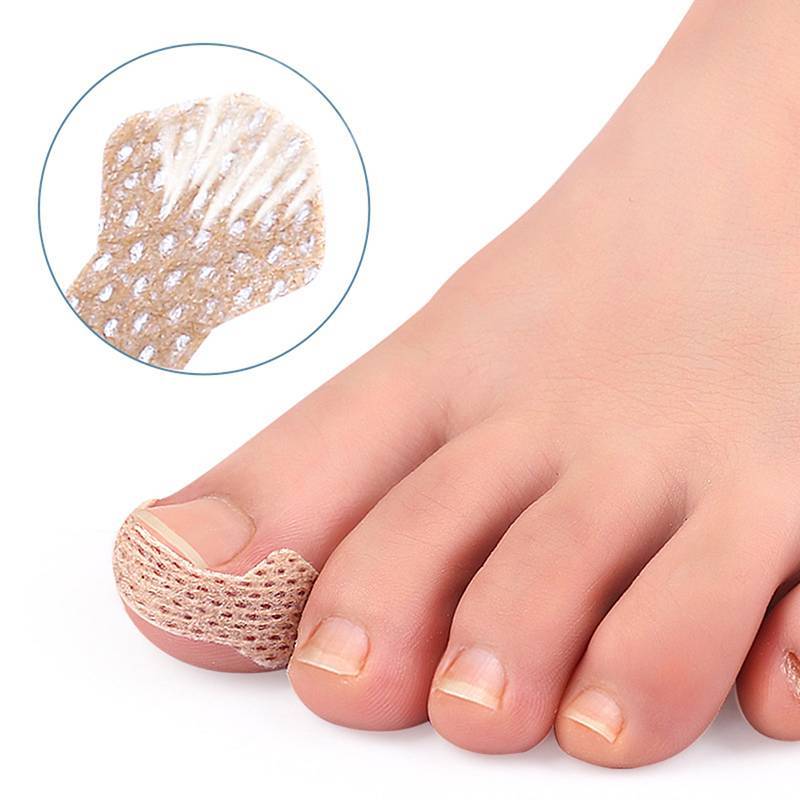 HFSHY 4 / 10 Tờ Dụng cụ làm móng chân mọc ngược Móng chân cho thợ sửa móng tay Paronychia Điều trị Fixer Phục hồi chăm sóc bàn chân Bunion VN