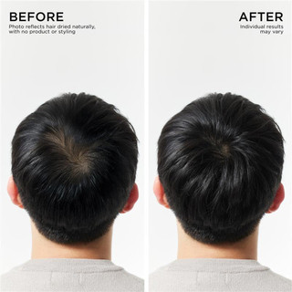 Dr. Groot Intensive Care Multi-Perfection Hair Loss Control Shampoo