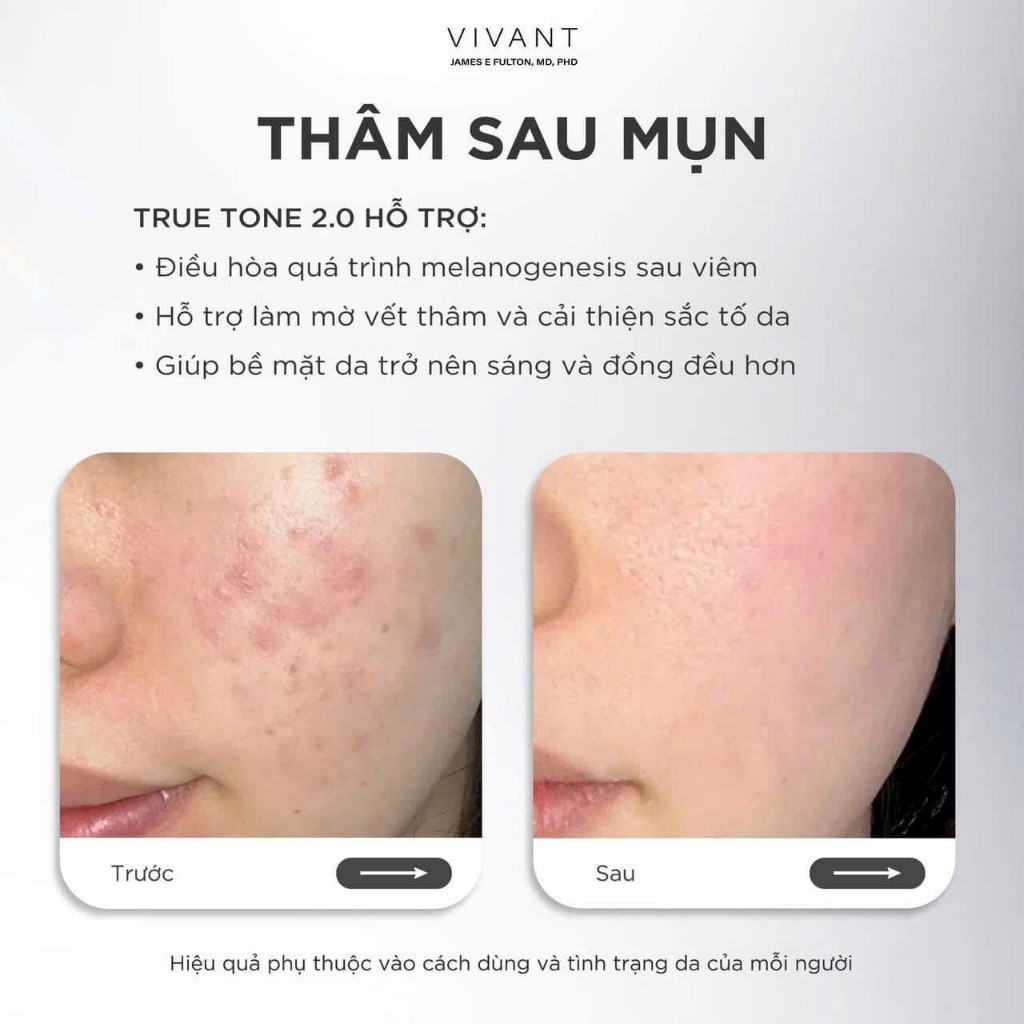 [HÀNG CÔNG TY] Serum True Tone 2.0 Vivant Skincare  30ml | Dưỡng Sáng Căng Bóng Da
