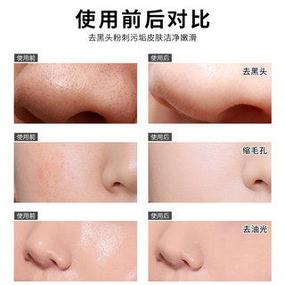 Ginia Mặt nạ mũi 6g hút mụn đầu đen, loại bỏ mụn đầu đen, làm sạch da, lột mụn 30g cho nam nữ 6.21 Q7E8