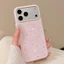 Star Dog Gilding Giá đỡ từ tính Vỏ điện thoại mềm cho iPhone 17 Pro Max 16 15 14 13 Vỏ bảo vệ chống sốc