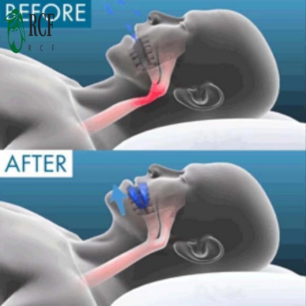 Ống ngậm chống ngáy có thể tái sử dụng - Miếng bảo vệ miệng thoải mái để thở dễ dàng