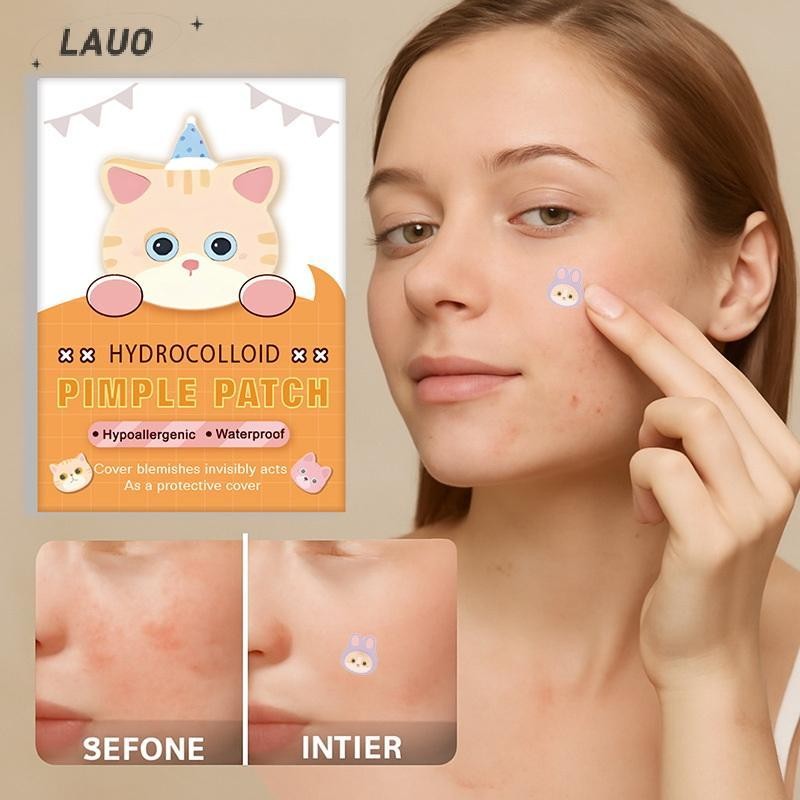 Springevenstar 600 Chiếc Miếng Dán Mụn Hình Hỗ trợ giảm mụn Miếng Dán Điều Hỗ trợ giảm mụn Nhiều Màu Sắc Vỏ Mụn Loại Bỏ Miếng Dán Mụn Chống Mụn Hydrocoloid Miếng Dán Springevenstar