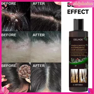 100Ml dầu gội tóc Bọt Giàu kiểm soát dầu Chăm Sóc Tóc Chống-Gàu Chống-Ngứa Dầu Gội Đầu Cho Nam Nữ