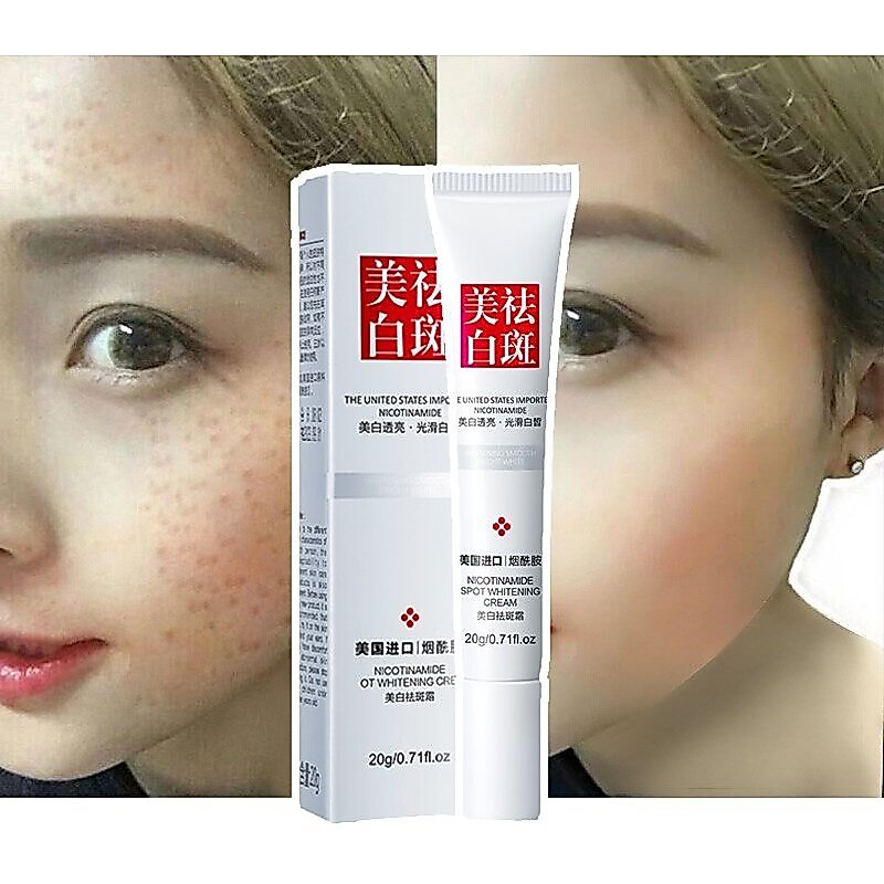 Kem Dưỡng Trắng Da Mặt Loại Bỏ Tàn Nhang Và Đốm Đen 20g