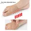 Có Thể Điều Chỉnh Hallux Valgus Bunion Corrector Chỉnh Hình Ngón Chân Lớn Tách Ngón Tay Cái Chỉnh Sửa Móng Chân Chân