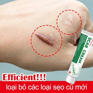 Xóa sẹo nhanh chóng