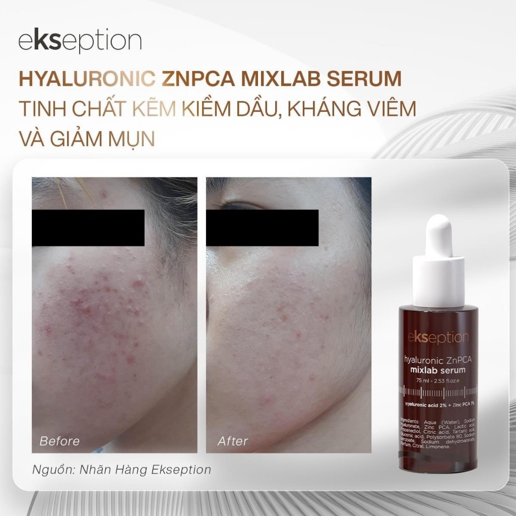 [HÀNG CÔNG TY] Serum Ekseption Hyaluronic ZnPCA Mixlab 75ML | Kiểm Soát Dầu Giảm Mụn