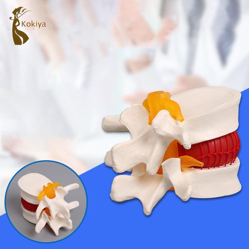 Mô hình thoát vị đĩa Mô hình cột sống 1: 1 để giảng dạy Hiển thị học tập
