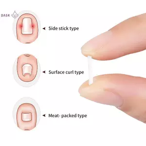 10 Cái Dụng cụ chỉnh sửa móng chân mọc ngược Mũi mọc ngược Điều trị móng tay Miếng dán đàn hồi Stier Kẹp thẳng Nẹp Dụng cụ làm móng chân