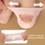 2 Chiếc Gel Silicon Thumb Corrector Bunion Foot Toe Hallux Valgus Protector Separator Finger Straightener Điều Chỉnh