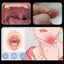 Dụng cụ tẩy đá Tonsil Sáp tai Đèn LED Dụng cụ chăm sóc làm sạch miệng bằng thép không gỉ