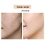 MACK ANDY Golden Diamond Repairing Liquid Foundation Dưỡng Ẩm Dưỡng Ẩm Nuôi Dưỡng Da Kiểm Soát Dầu Chống Mồ Hôi Chống Mồ Hôi Kem Nền Trang Điểm Không Tháo Rời