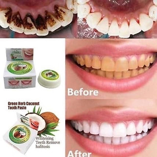 Kem Tẩy Trắng Răng Loại Bỏ Ố Vàng Làm Trắng Răng Green Herbal Novolife Thái Lan