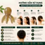 Lược Massage Da Đầu HomeMate Hình Bạch Tuộc, Lược Gội Đầu Thư Giãn Nhỏ Gọn Chăm Sóc Tóc