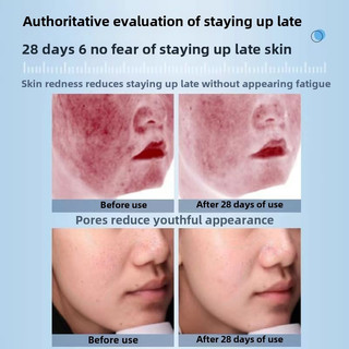 SNOW HERBS ELITE Radiance Double Anti Smearing Facial Mask Chống oxy hóa Phai nếp nhăn Làm sáng da Làm trắng da và ở lại Mặt nạ mặt muộn