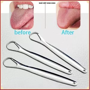 THÉP KHÔNG GỈ 304, DỤNG CỤ LÀM SẠCH LƯỠI, Giúp Loại Bỏ Mảng Bám, Dễ Dàng Sử Dụng