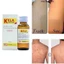 LOTION KELLA VIÊM LỖ CHÂN LÔNG, VIEM DA THÁI LAN