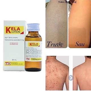 [CHỈ BÁN HÀNG THÁI] LOTION KELLA VIÊM LỖ CHÂN LÔNG,  VIEM DA THÁI LAN