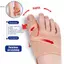 1 Cặp Dụng Cụ Tách Ngón Chân Lớn Bunion Corrector Hallux Valgus Chỉnh Sửa Thiết Bị Xương Ngón Tay Cái Chỉnh Hình Bàn Chân Trước Pad Máy duỗi chân