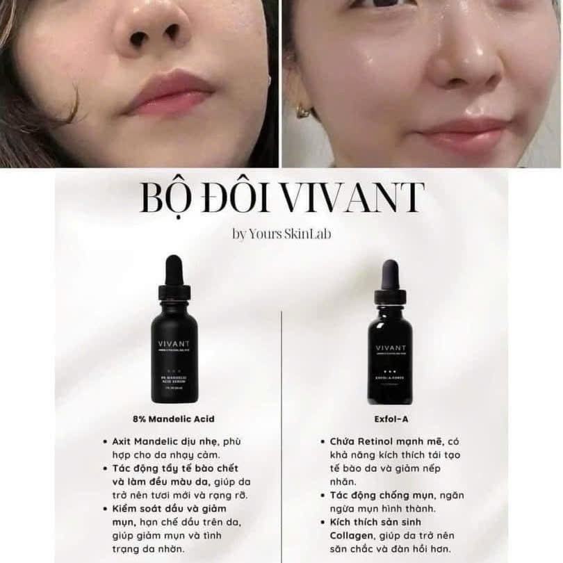 [HÀNG CÔNG TY] Tinh chất Vivant Skincare Exfol-A 30ml | Giảm Mụn, Căng Bóng, Sáng Da, Chống Lão Hoá