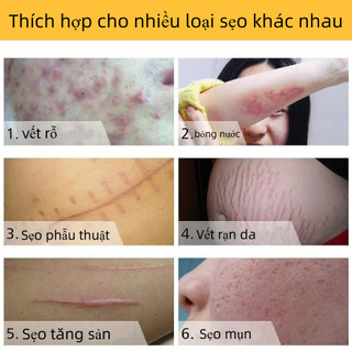 Xóa sẹo nhanh chóng