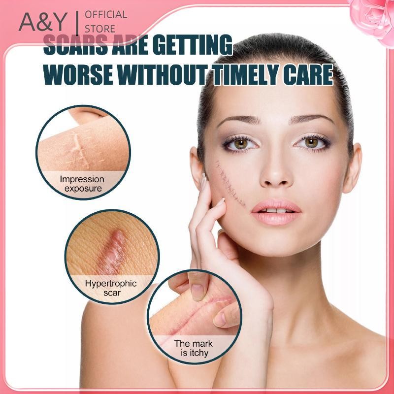 A & Y 1 Cuộn Silicon Gel Scar Sheet Miếng Dán Điều Trị Loại Bỏ Băng Bao Đốt Chấn Thương Sửa Chữa Mụn Tai Sẹo Phần Làm Đẹp Da.