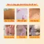 combo 2 lọ Kem bôi đánh bay mụn thịt, mụn nhỏ ở cổ, mụn cóc, nách –, làm sáng da, mịn da, tái tạo da hiệu quả.