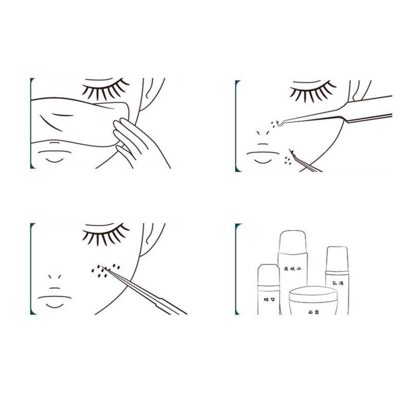 Alittlesetrtu Cell Mụn Đầu Đen Kẹp Nhíp Thẩm Mỹ Viện Cạo Đặc Biệt Mụn Kim VN