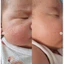 KEM DƯỠNG MLE ATOPALM 100ML