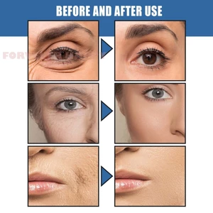 30ml Retinol Kem Mắt Cho Nữ Chống Nhăn Giảm Crow 's Feet Cream Dark Circles Spots
