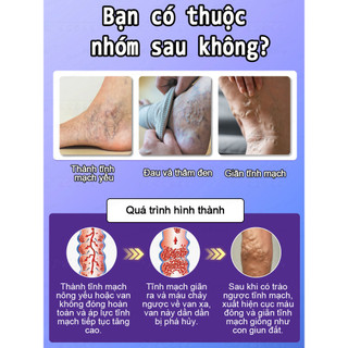 [Nhập khẩu từ Hàn Quốc] Loại bỏ tĩnh mạch Laser có thể giảm đau, giúp giảm giãn tĩnh mạch, ngăn ngừa giãn tĩnh mạch và làm dịu chân