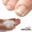 DWEL 50 Cái / hộp Miếng Dán Đàn Hồi, Miếng Lót Làm Đầy Móng Tay Dụng Cụ Chỉnh Sửa Móng Chân Phát Triển, Dụng Cụ Làm Móng Chân Nẹp Nhựa Dụng Cụ Làm Móng Chân Phát Triển Ngón Chân Điều Trị Móng Tay Kẹp Thẳng