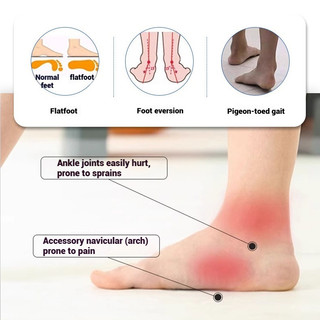 Dép hỗ trợ vòm Massage - Dép chỉnh hình chống trượt có điểm bấm huyệt, chỉnh sửa chân phẳng Giày nhà ngoài trời trong nhà