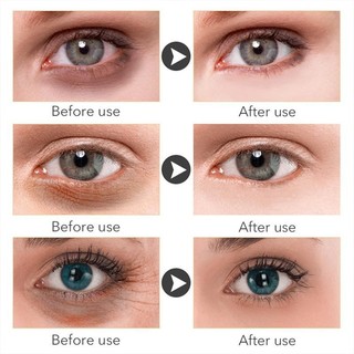 (Chính Hãng) Kem Dưỡng Da Mắt xóa nhăn collagen Đánh Bay Nếp Nhăn, Quầng Thâm,  Bọng Mắt Nếp Nhăn chỉ sau 1 ngày