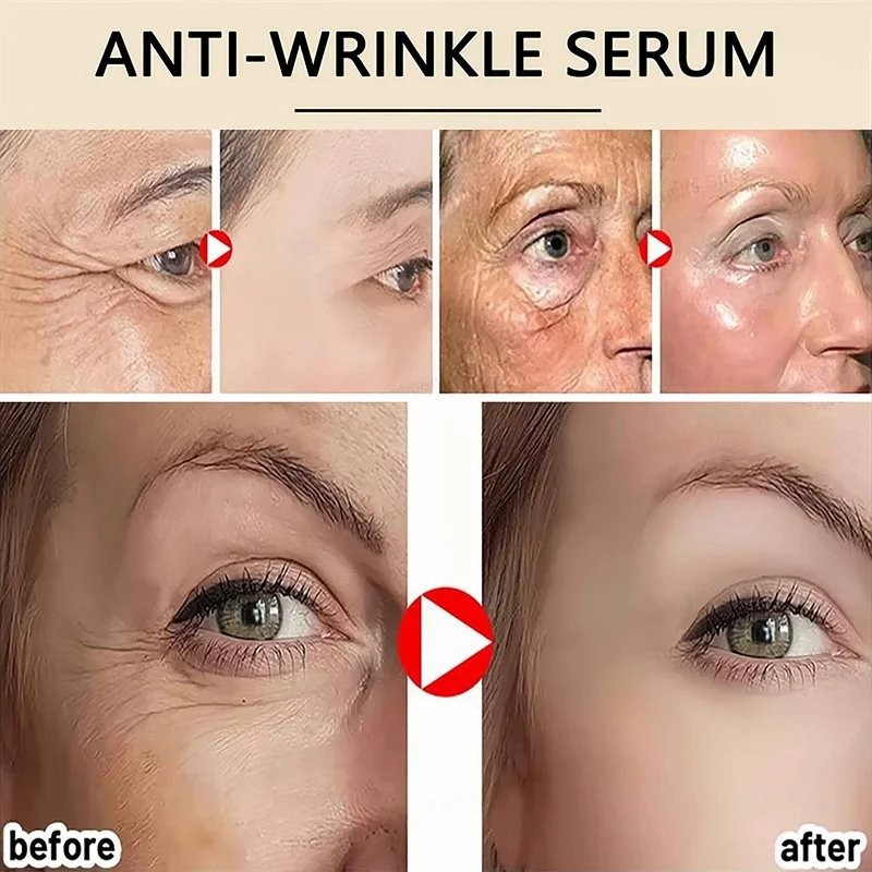 Bán SEOUL 1988 Vitamin C Chăm Sóc Nhăn 4% Retinol Tinh Chất Nhân Sâm Kem Dưỡng Ẩm Mắt