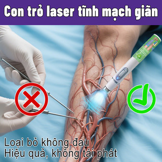 [Nhập khẩu từ Hàn Quốc] Loại bỏ tĩnh mạch Laser có thể giảm đau, giúp giảm giãn tĩnh mạch, ngăn ngừa giãn tĩnh mạch và làm dịu chân