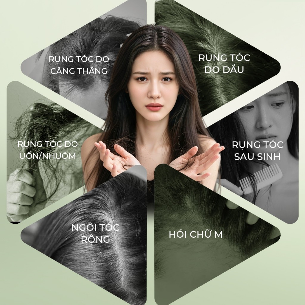 Xịt mọc tóc Lab on Hair 160ml xịt dưỡng tóc với giấm táo Kích thích mọc tóc Rụng Tóc