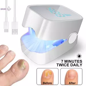 Thiết bị điều trị móng tay nấm Sửa chữa móng tay Công cụ hỗ trợ Laser Nấm móng tay Loại bỏ hiệu quả Dụng cụ chăm sóc móng chân