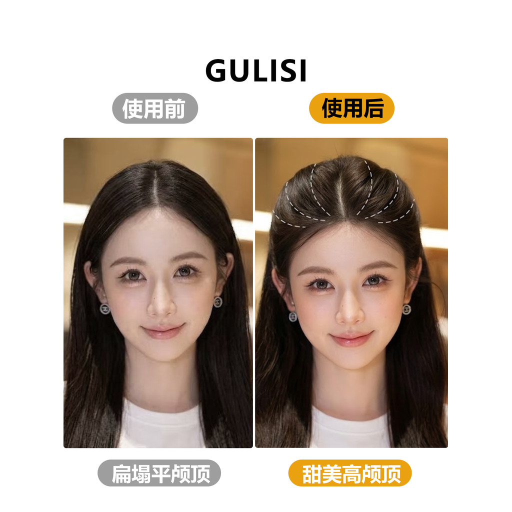 🔥có hàng sẵn🔥Lược Chải Tóc Dạng Kéo phụ kiện tóc nữ ins style Công Chúa Hàn Quốc Đầu Upside Xuống Lược Tóc Cao Đầu Lâu Top Dụng Cụ Tiện Dụng Lười Nổ Bên Bị Gãy Lược Tóc Răng Vô Hình Kẹp Tóc