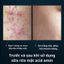Sữa rửa mặt Images acid amin sạch sâu loạI bỏ mụn dầu thừa nhanh chóng
