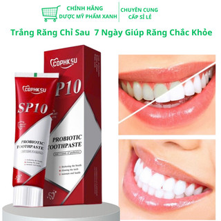 Kem đánh răng SP10 làm trắng răng vượt trội, làm sạch mạnh mẽ loại bỏ vết ố vàng bảo vệ men răng vượt trội