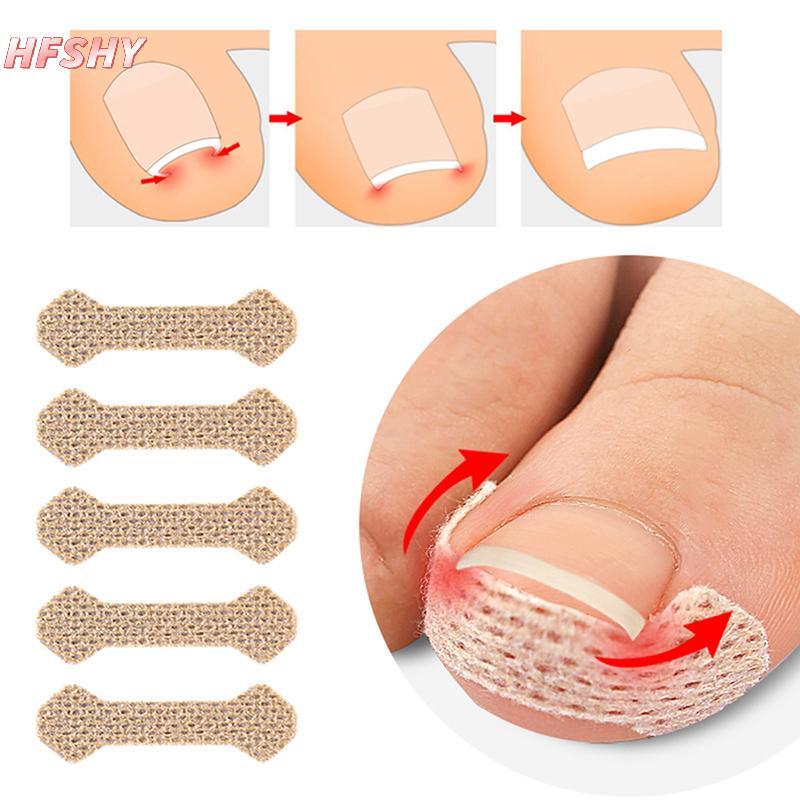 HFSHY 4 / 10 Tờ Dụng cụ làm móng chân mọc ngược Móng chân cho thợ sửa móng tay Paronychia Điều trị Fixer Phục hồi chăm sóc bàn chân Bunion VN