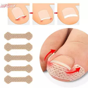HFSHY 4 / 10 Tờ Dụng cụ làm móng chân mọc ngược Móng chân cho thợ sửa móng tay Paronychia Điều trị Fixer Phục hồi chăm sóc bàn chân Bunion VN
