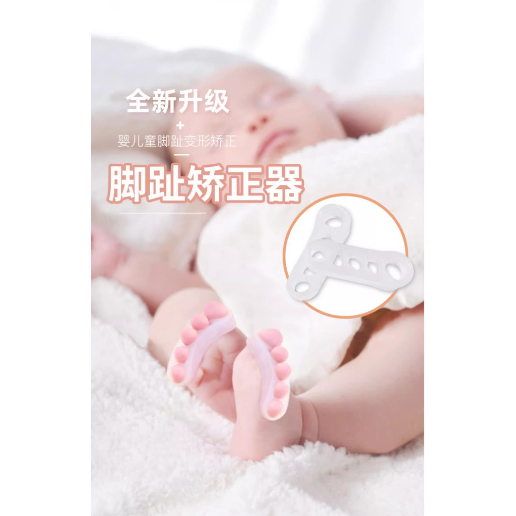 Trẻ sơ sinh Trẻ em Bé Mũi Corrector Ngón chân chồng chéo cong chống rách Ngón tay cái Valgus Ngón chân 25.7.3