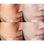 Mặt nạ bùn ủ trắng da mặt làm trắng bật tông da nhanh chóng chỉ sau 20 phút