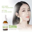 Serum hỗ trợ giảm mụn, ngừa thâm mụn Dr.PONG 28D Whitening Drone Acne Serum 15ml